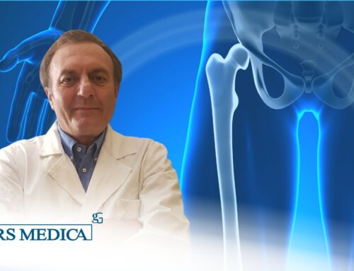 Osteosintesi femore: intervento entro le 24/48 h dal trauma